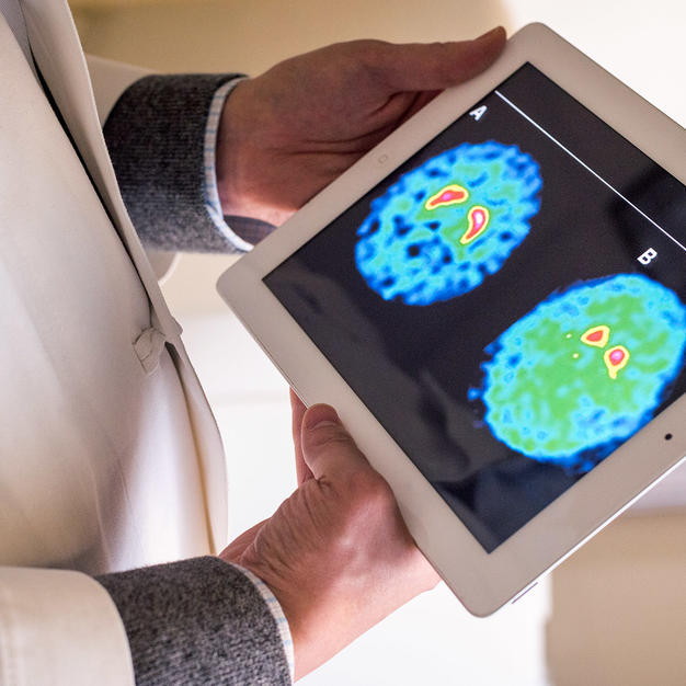 Doctor holding iPad with image of a brain scan.