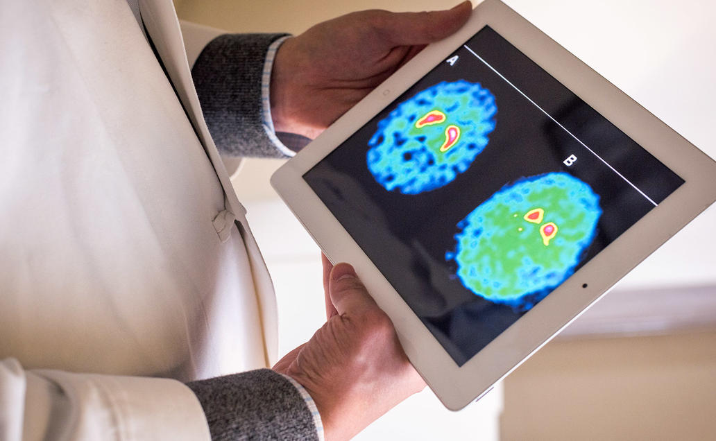 Doctor holding iPad with image of a brain scan.