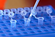 Genetic testing