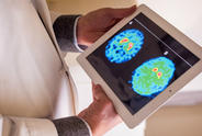 Brain Scan on Tablet