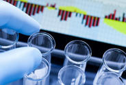Funded Research: Relief for Constipation, Looking for a New Causative Gene, and the Genetics of Gender Differences in Parkinson’s Disease