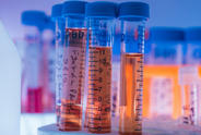 Lab Tubes