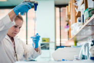 MJFF Scientist Highlights Alpha-synuclein Research Progress in Nature Reviews Drug Discovery