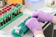 Blood tests