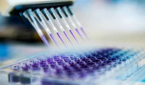 17 New Genetic Variants Linked To Parkinson's Disease