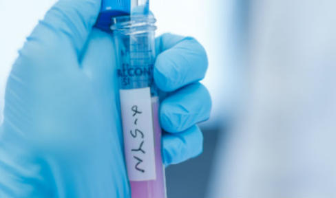 New Information on the Parkinson's-Gut Connection