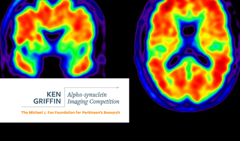 Ken Griffin Alpha-Synuclein Imaging Competition 