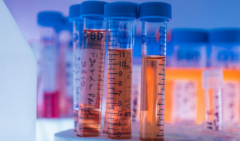 Two New Parkinson's Drugs Approaching Market: FDA Set to Rule on Novel Treatments Funded by MJFF in Early Development