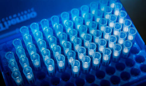 $24-Million Public-Private Partnership Expands Investigation of Parkinson's Disease