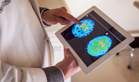 Study Reveals Risk Factors for Early Psychosis in Parkinson's