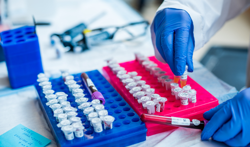 Samples in the lab