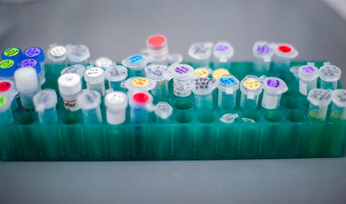 Parkinson's Tozadenant Trial Discontinued