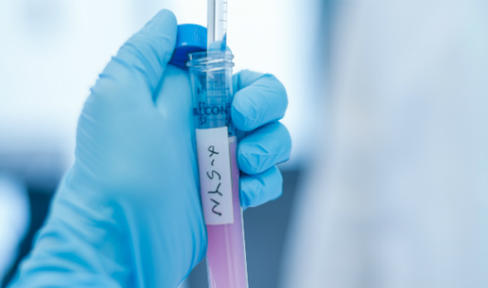 Latest Trials against Top Parkinson's Protein Alpha-synuclein