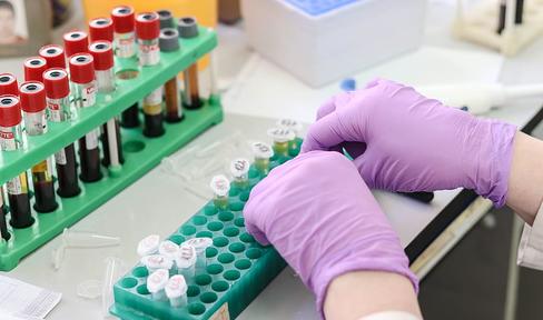 Blood tests