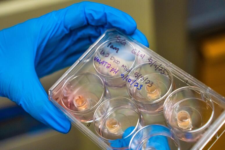 hands wearing blue medical gloves hold a clear box of specimen samples 