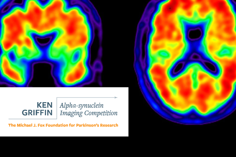 Ken Griffin Alpha-Synuclein Imaging Competition